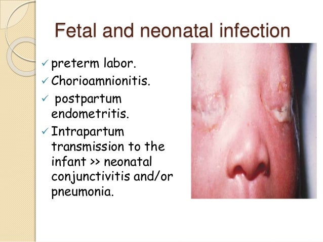 sexual transmission disease Sexual transmission disease